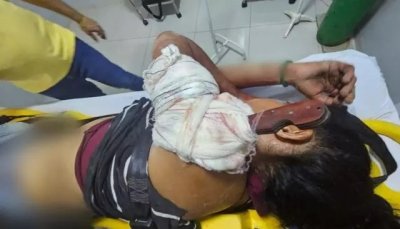 Mulher sendo socorrida com a faca cravada no ombro aps ser agredida (Foto: Direto das Ruas)