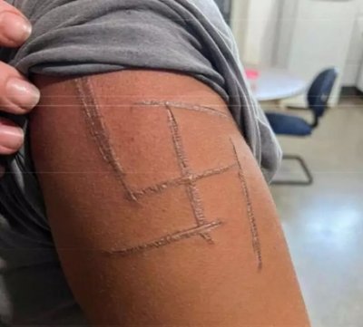 Su�stica marcada no bra�o da v�tima acusada de furto (Foto: Reprodu��o processo)